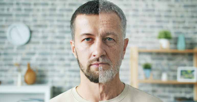 Age Progression